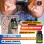 PILES MATRIX Vein Restore + Rectum Restore Medicine + Guide & Diet Booklet | 100% Natural Ayurvedic Treatment - by The Yoga Man Lab